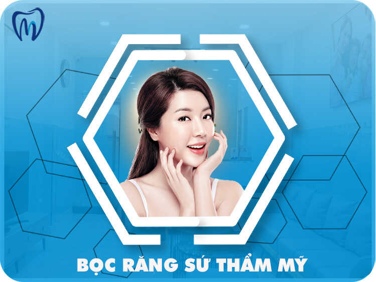 BỌC RĂNG SỨ THẨM MỸ