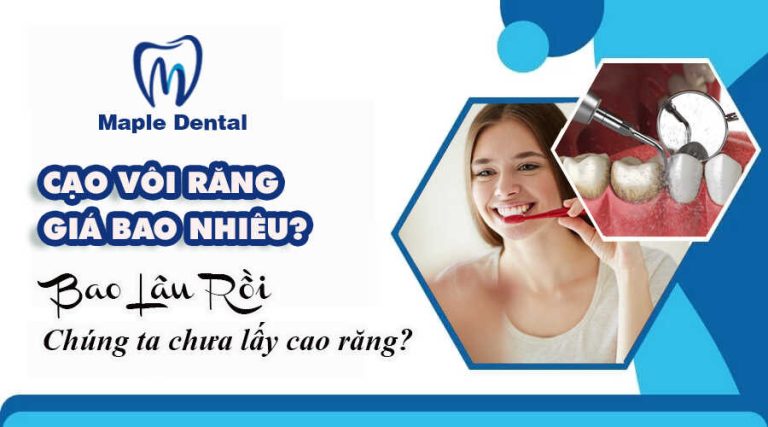 Cạo Vôi Răng Giá Bao Nhiêu?