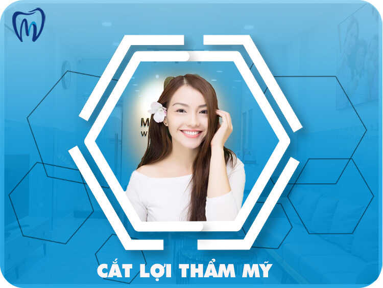 CẮT LỢI THẨM MỸ