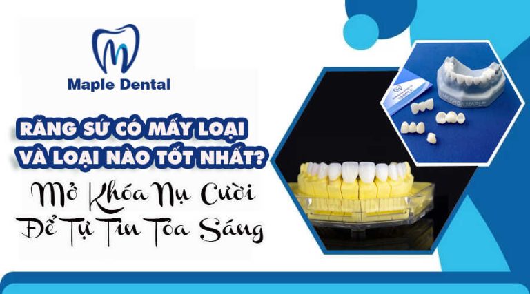 Răng Sứ Có Mấy Loại Và Loại Nào Tốt Nhất ?