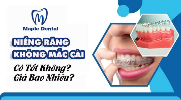 Niềng Răng Không Mắc Cài Có Tốt Không? Giá Bao Nhiêu?