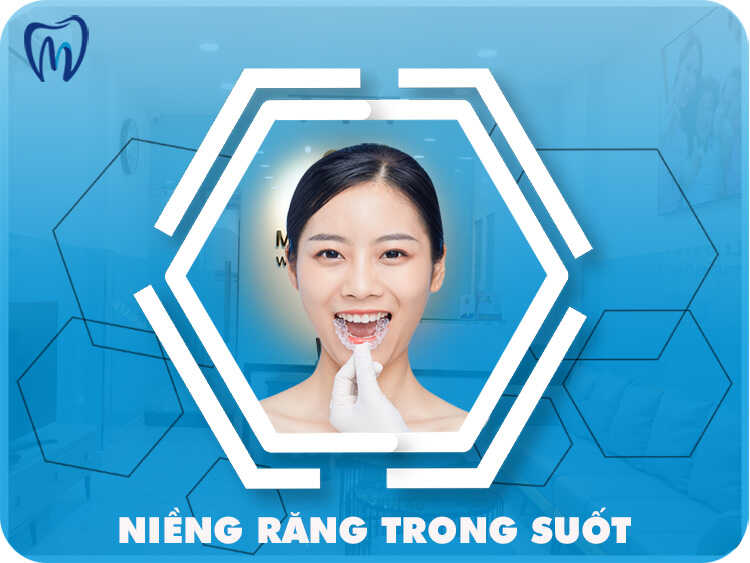 NIỀNG RĂNG TRONG SUỐT