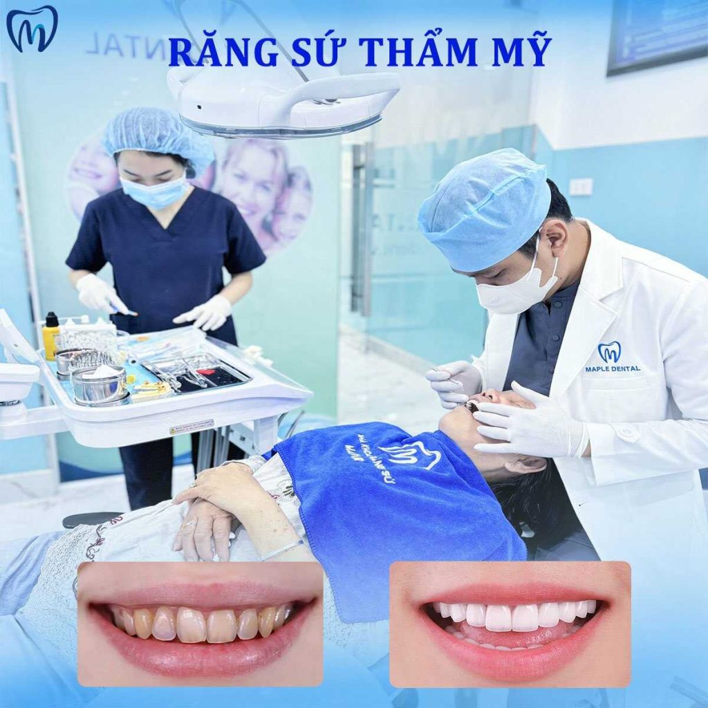 răng sứ thẩm mỹ