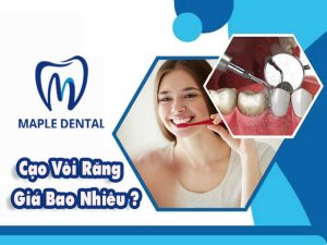 Cạo Vôi Răng Giá Bao Nhiêu?