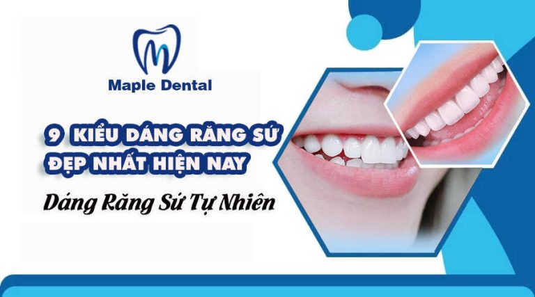 Top 9 Các Dáng Răng Sứ Đẹp Được Ưa Chuộng Nhất Hiện Nay