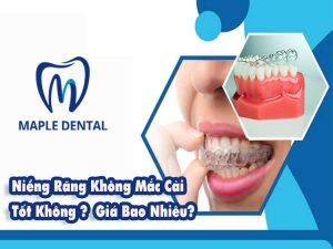 Niềng Răng Không Mắc Cài Có Tốt Không? Giá Bao Nhiêu?