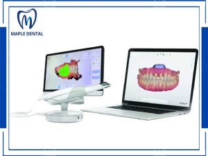 Scan Trên Miệng 3D