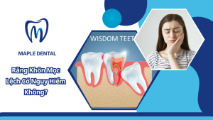 Răng Khôn Mọc Lệch Có Nguy Hiểm Không?