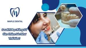 Sau Khi Bọc Răng Sứ Cần Chăm Sóc Như Thế Nào?