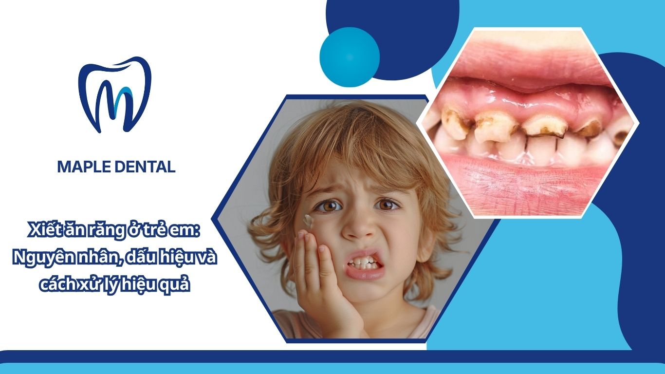 Cách trị xiết ăn răng