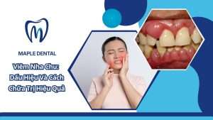 Viêm Nha Chu: Dấu Hiệu Và Cách Chữa Trị Hiệu Quả