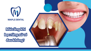 Mài Răng Khi Bọc Răng Sứ Có Đau Không? Có Hại Không?