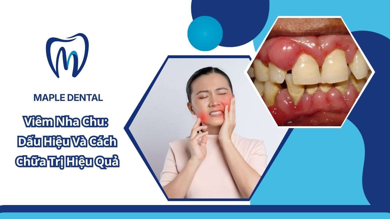 viêm nha chu