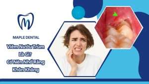 Viêm Nướu Trùm Là Gì? Có Nên Nhổ Răng Khôn Không