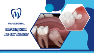 Nhổ Răng Khôn Bao Lâu Thì Lành? Bác Sĩ Giải Đáp