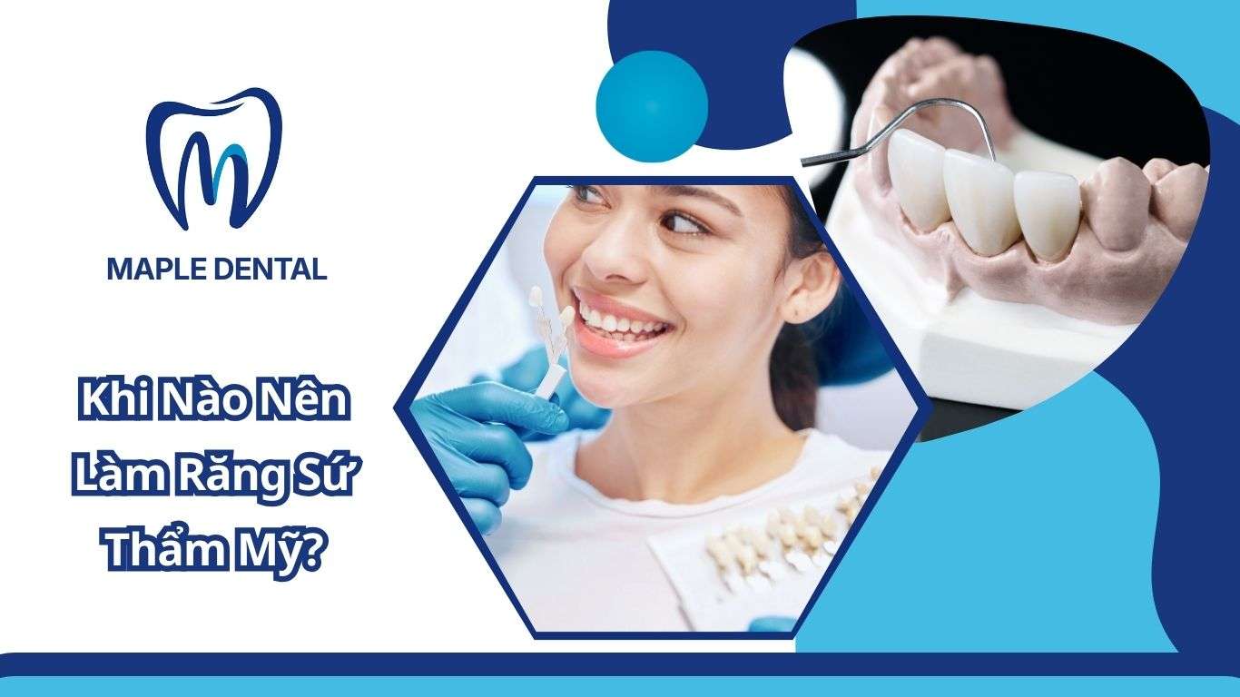 răng sứ thẩm mỹ