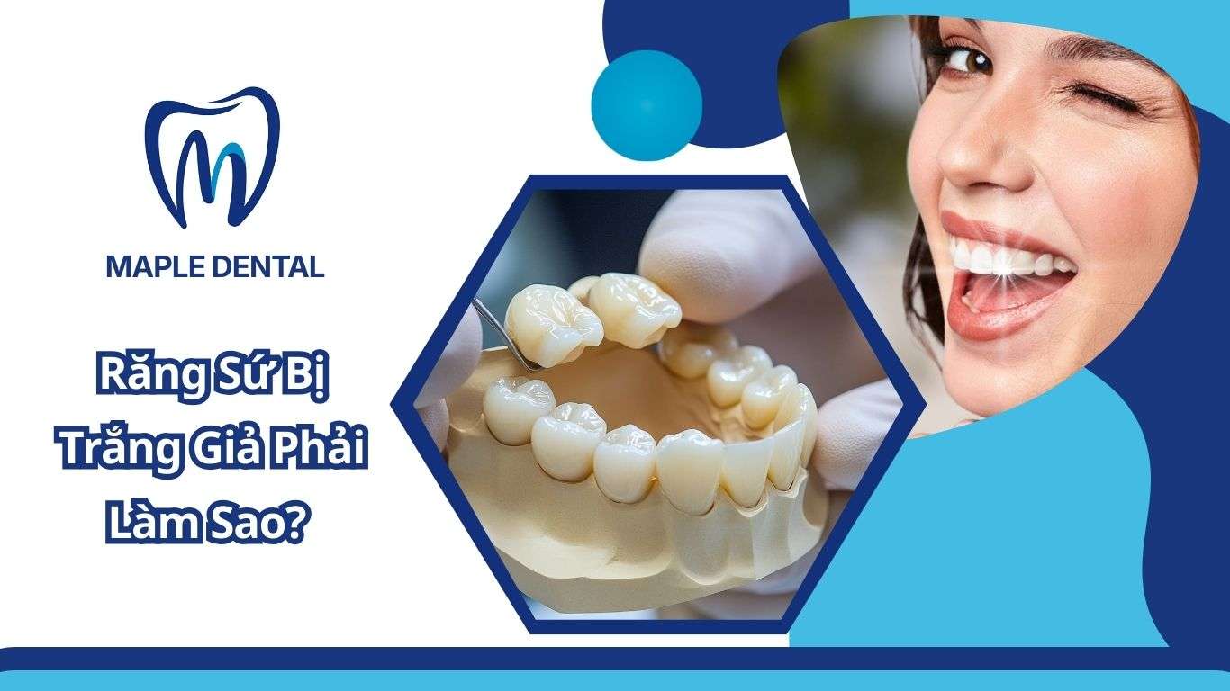 răng sứ trắng giả