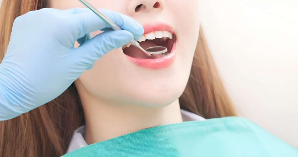 Cạo vôi vệ sinh răng miệng định kì