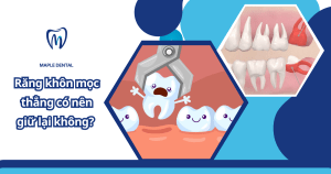 Răng khôn mọc thẳng có nên giữ lại không? Bác sĩ giải đáp