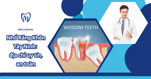 Nhổ Răng Khôn Tây Ninh: địa chỉ uy tín, an toàn