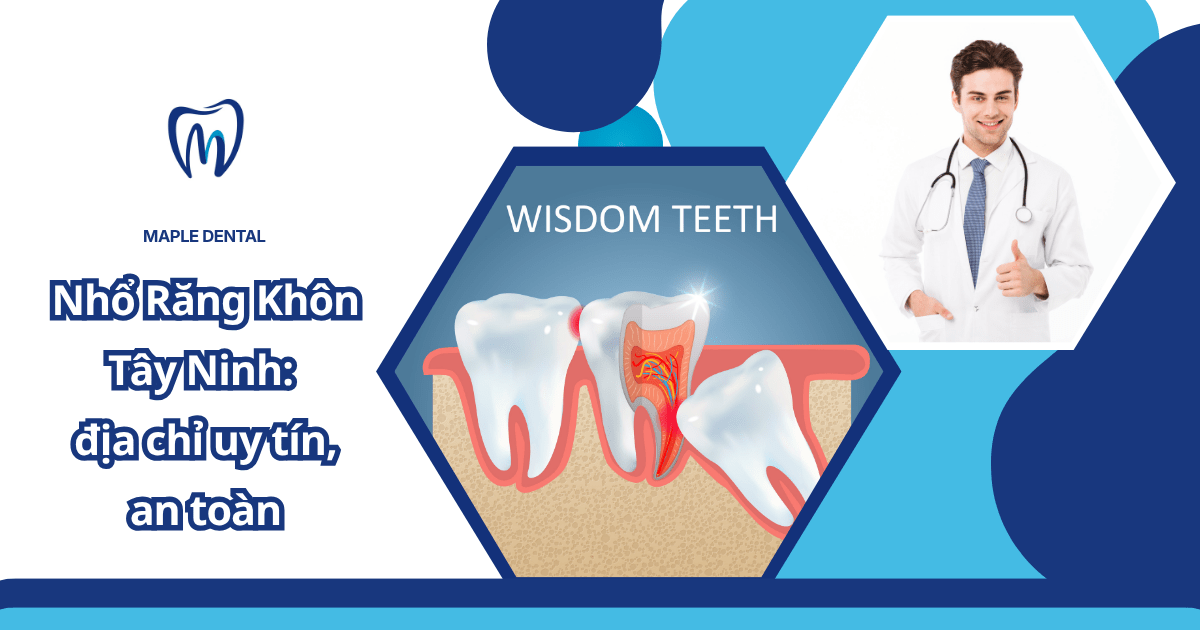 Nhổ răng khôn Tây Ninh