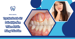 Tụt Nướu Là Gì? Dấu Hiệu Âm Thầm Khiến Răng Yếu Dần