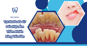 Cao Răng Gây Viêm Nướu Như Thế Nào?