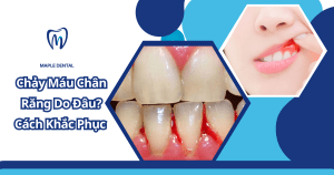 Chảy Máu Chân Răng Do Đâu? Cách Khắc Phục