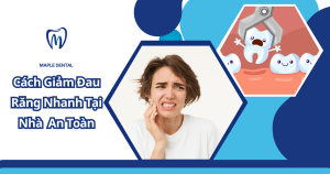 Cách Giảm Đau Răng Nhanh Tại Nhà An Toàn
